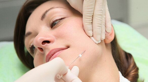 Thread lifting - method of cosmetic facial rejuvenation after 45 years