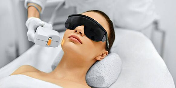Laser skin resurfacing procedure