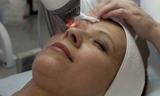 eyelid surgery to rejuvenate the skin around the eyes